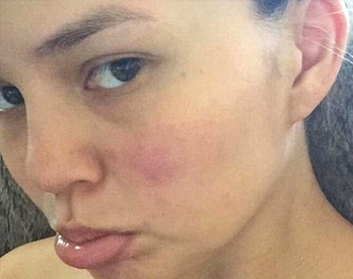 Chrissy Teigen senza makeup su Instagram