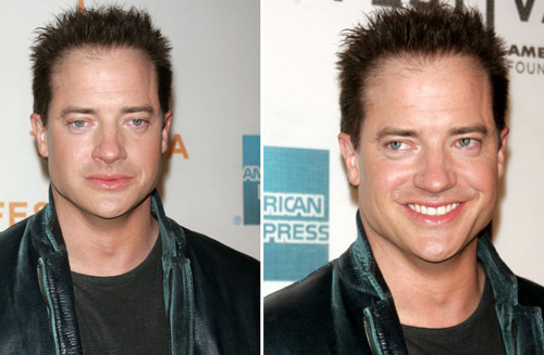 brendancapellioddio Cosè successo ai capelli di Brendan Fraser?!