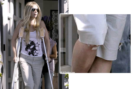 gwynethfattamale Gwyneth Paltrow con le stampelle