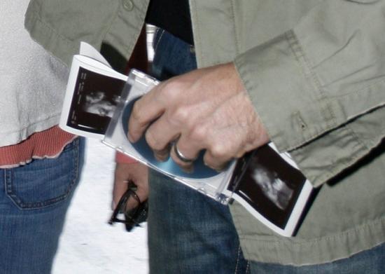 mr fp 109702 0 preview Di chi è questa ecografia?