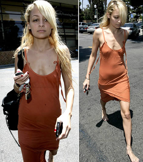 nicolerichiearancionee Nicole Richie a piedi nudi per strada