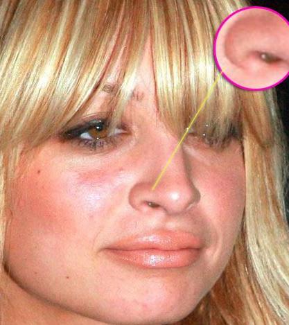 nose E quello cosè?!