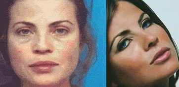 ybnomakeup1 Altre star senza trucco