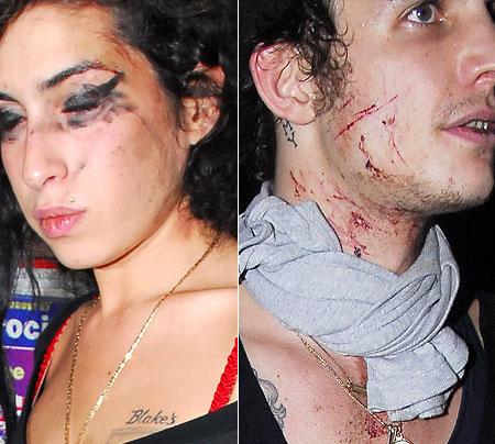 amy fight hubby Amy e il marito ridotti male