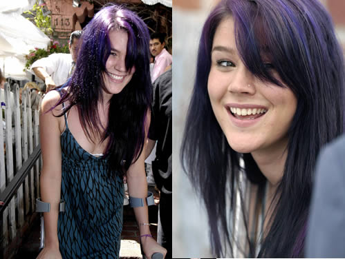 jossviola Joss Stone con le stampelle