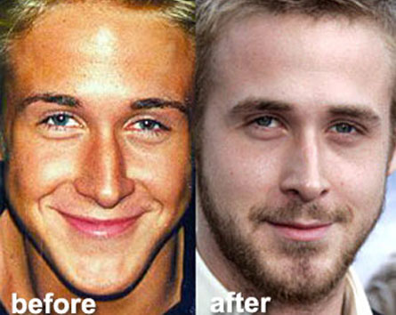 ryangoslingnaso Ryan Gosling si è rifatto il naso?