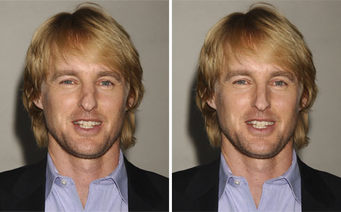 02 owenwilson Ritocchiamo i difetti delle star!