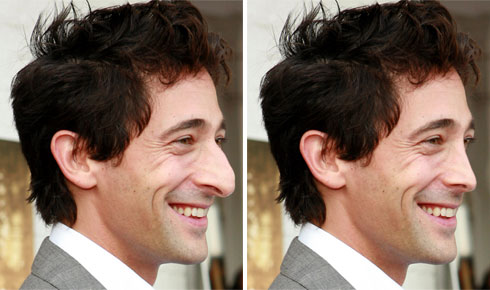 08 adrienbrody after Ritocchiamo i difetti delle star!