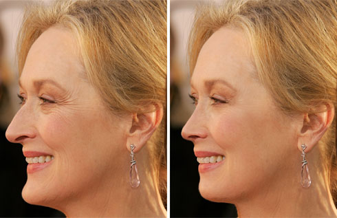 12 merylstreep Ritocchiamo i difetti delle star!