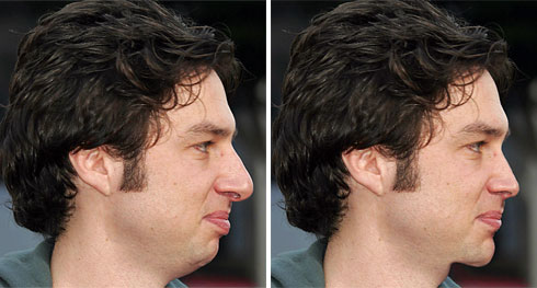 18 zachbraff Ritocchiamo i difetti delle star!