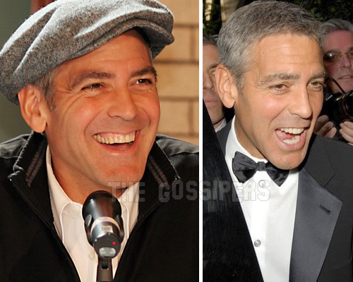 clooneydenti Denti nuovi per George Clooney
