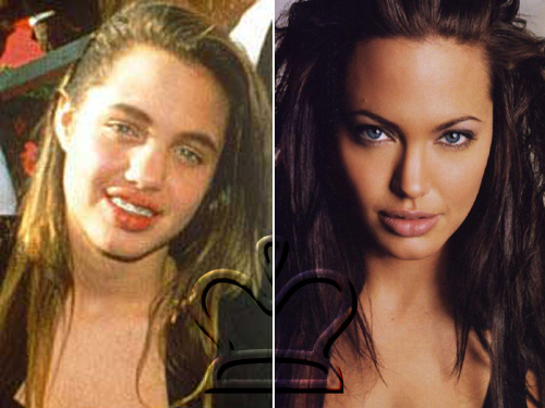 angieprimadopo Da brutto anatroccolo a cigno: Angelina Jolie
