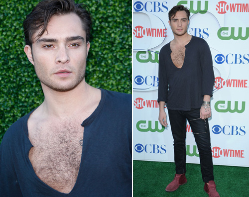 cbs petto ed westwick Ed mette in mostra il petto villoso