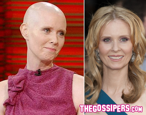 cynthia calva Cynthia Nixon calva per lavoro