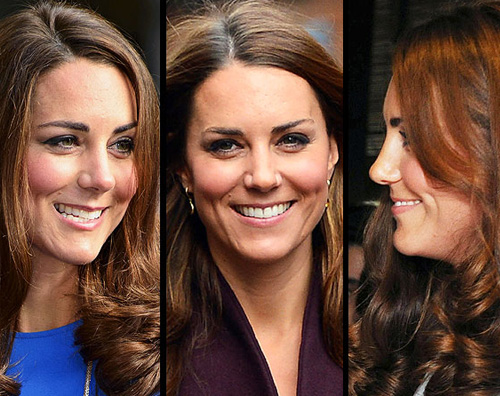 middleton naso Le donne si rifanno il naso alla Kate Middleton