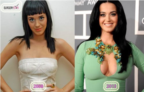 Katy Perry Breast Implant Katy Perry parla del suo seno: Nessun aiuto dal chirurgo