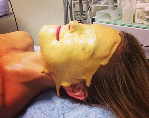 Trattamento alloro per Bar Refaeli bar refaeli Trattamento alloro per Bar Refaeli