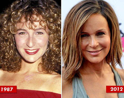 jennifer grey 7 celebrità che avrebbero dovuto evitare la chirurgia plastica