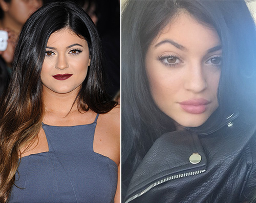 Kylie Jenner Lo strano caso di Kylie Jenner