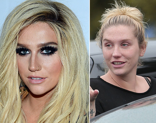 Kesha prima e dopo Ke$ha senza makeup a Los Angeles