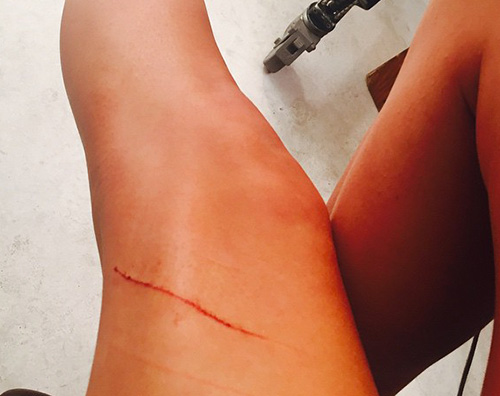 Taylor Swift Gamba Taylor Swift assicura le sue gambe per 40milioni