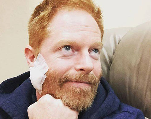 Jesse tyler Ferguson Jesse Tyler Ferguson di Modern Family operato per un melanoma