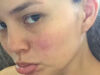 Chrissy Teigen senza makeup su Instagram