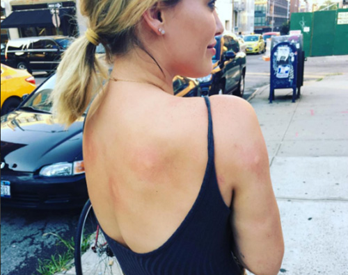 Hilary Duff Hilary Duff assalita dai mosquitos