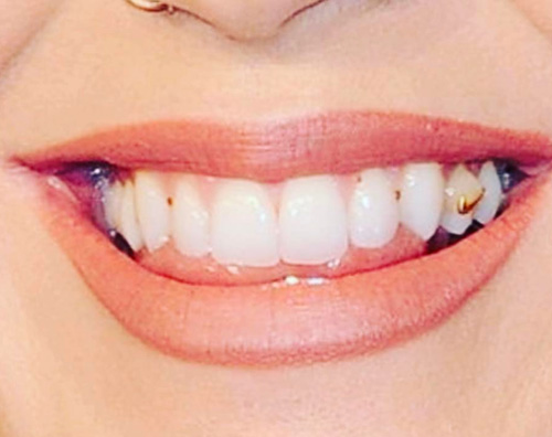 Katy Perry 1 Katy Perry sul red carpet con qualcosa tra i denti
