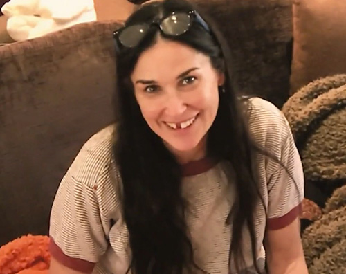 Demi Moore 1 Demi Moore: Ho perso i denti per colpa dello stress