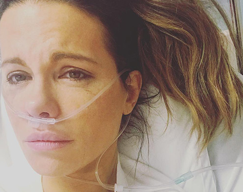 Kate Backinsale Kate Beckinsale, ricovero durgenza in ospedale