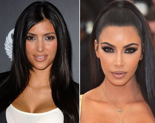 Kim Kardashian prima e dopo Kim Kardashian: Non mi sono mai rifatta il naso