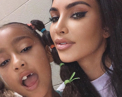 kim kardashian north west North West ha perso un dente