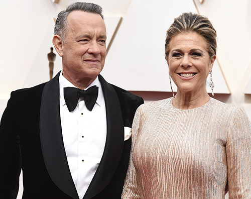 tom hanks rita wilson Thom Hansk e Rita Wilson continuano ad aggiornare i fan dopo il contagio