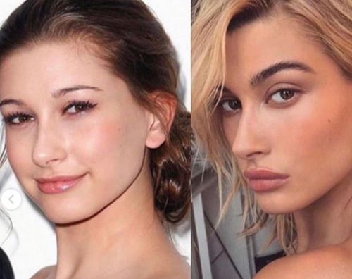 hailey 2 Haile Baldwin: Non ho mai ritoccato il mio viso