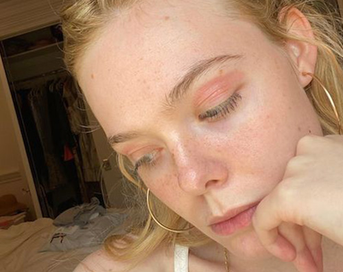 elle fanning 2 Ellen Fanning mostra i suoi sfoghi cutanei sulle palpebre