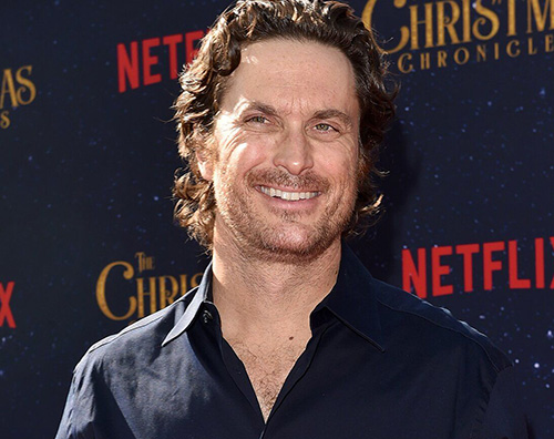 oliver hudson Oliver Hudson: Ho usato il botox e non me ne pento