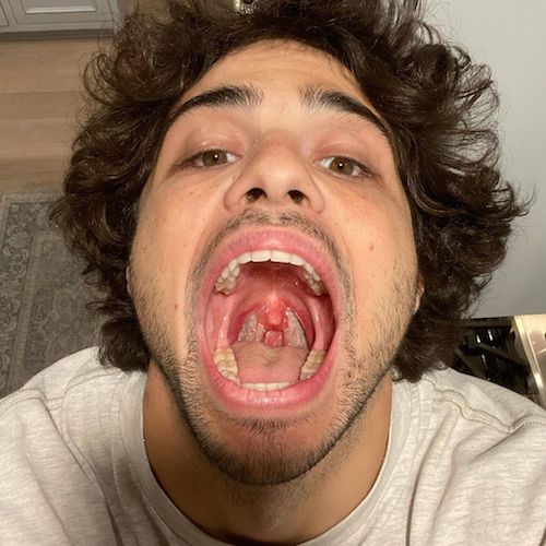 139654338 129789878978119 9214164290947265624 n Noah Centineo è stato operato alle tonsille