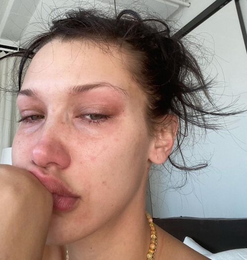 Schermata 2021 11 10 alle 16.06.03 Bella Hadid in lacrime sui social mentre parla della sua ansia